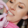 Achieving Total Facial Harmony: The Perfect Blend Of Veneer Dentistry And Aesthetic Surgery In McGregor, TX